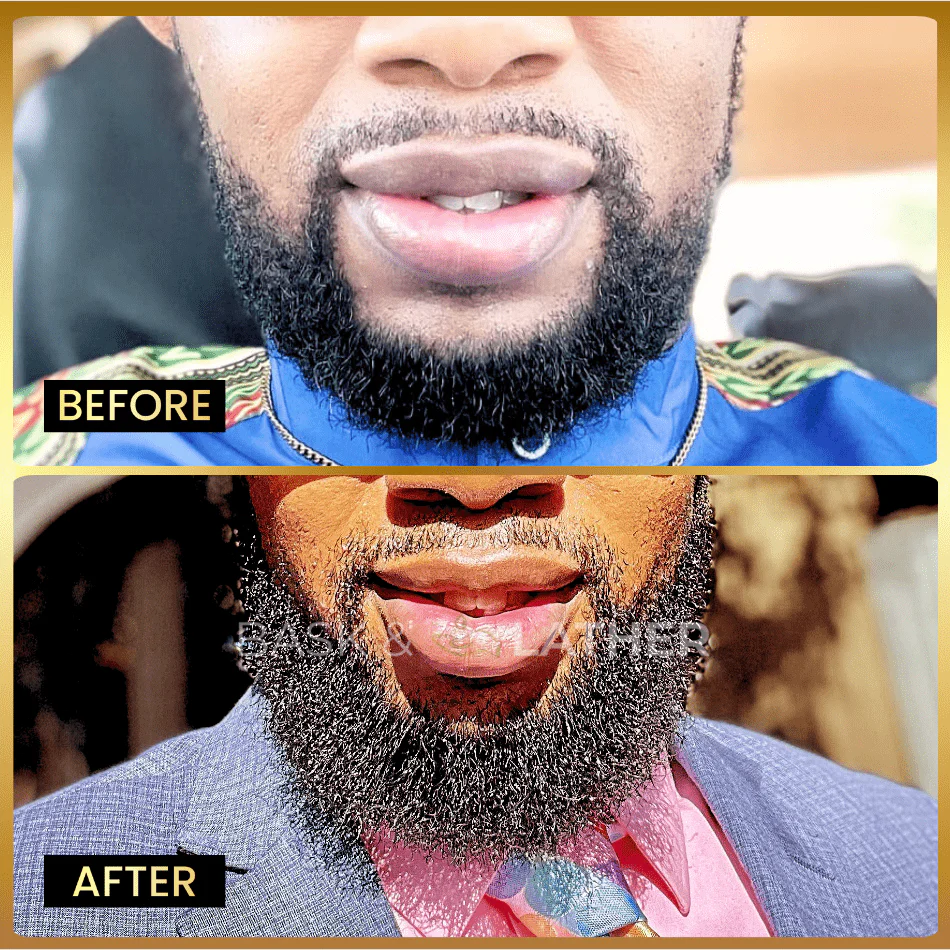 Beard Oil - Beard Softener & Growth Enhancer - Image 3
