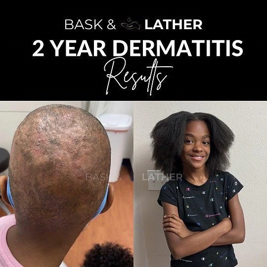 Nurture & Grow - Kids Healthy Hair Bundle - Image 3