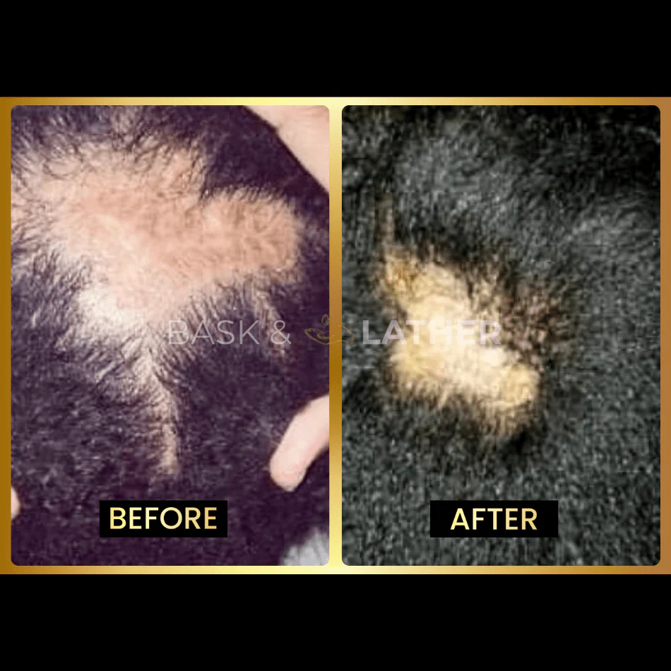 Scalp Stimulator - 3 Month Supply - Image 5
