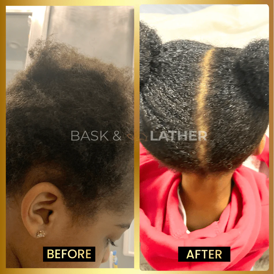 BALM - Stimulating Scalp & Hair Balm - Image 4