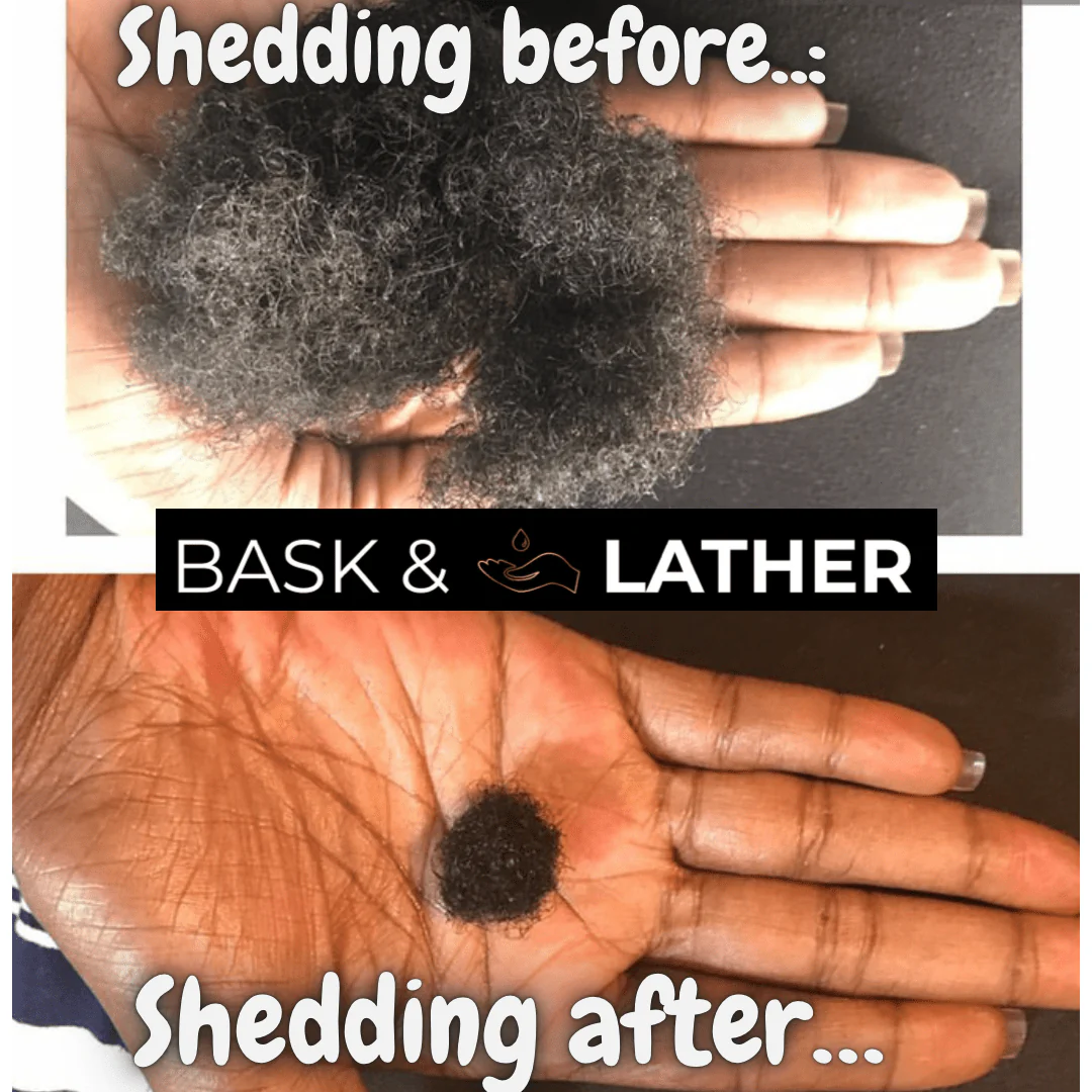 Healthy Hair Starter Kit - Limited Edition - Image 3