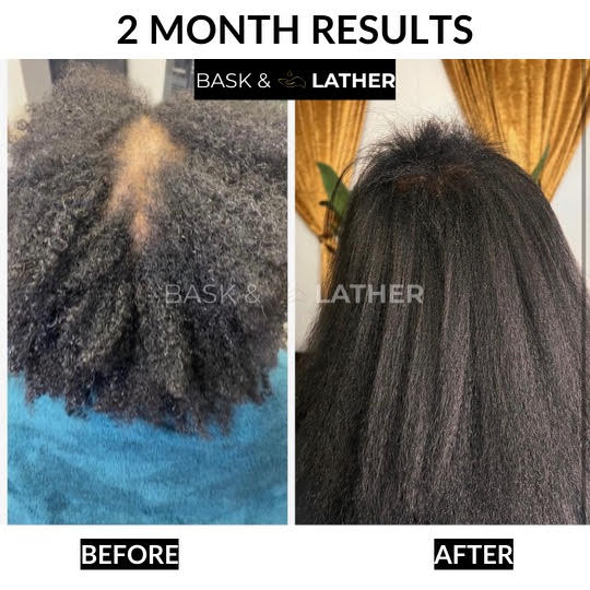 Healthy Hair Starter Kit - Limited Edition - Image 4
